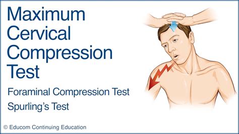 cervical compression test vs spurling's|positive axial compression test.